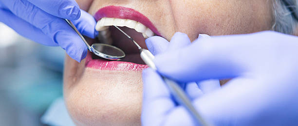 Best Emergency Wisdom Teeth Removal in Taylor Creek, FL